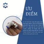 co noi khi nen xoay ksl